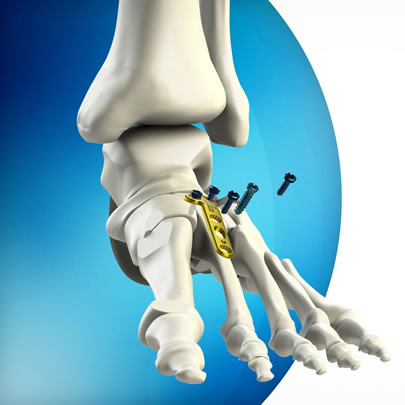 3D Animation Company & 3D Medical Animation Production Company 3D Animation Company & 3D Medical Animation Production Company